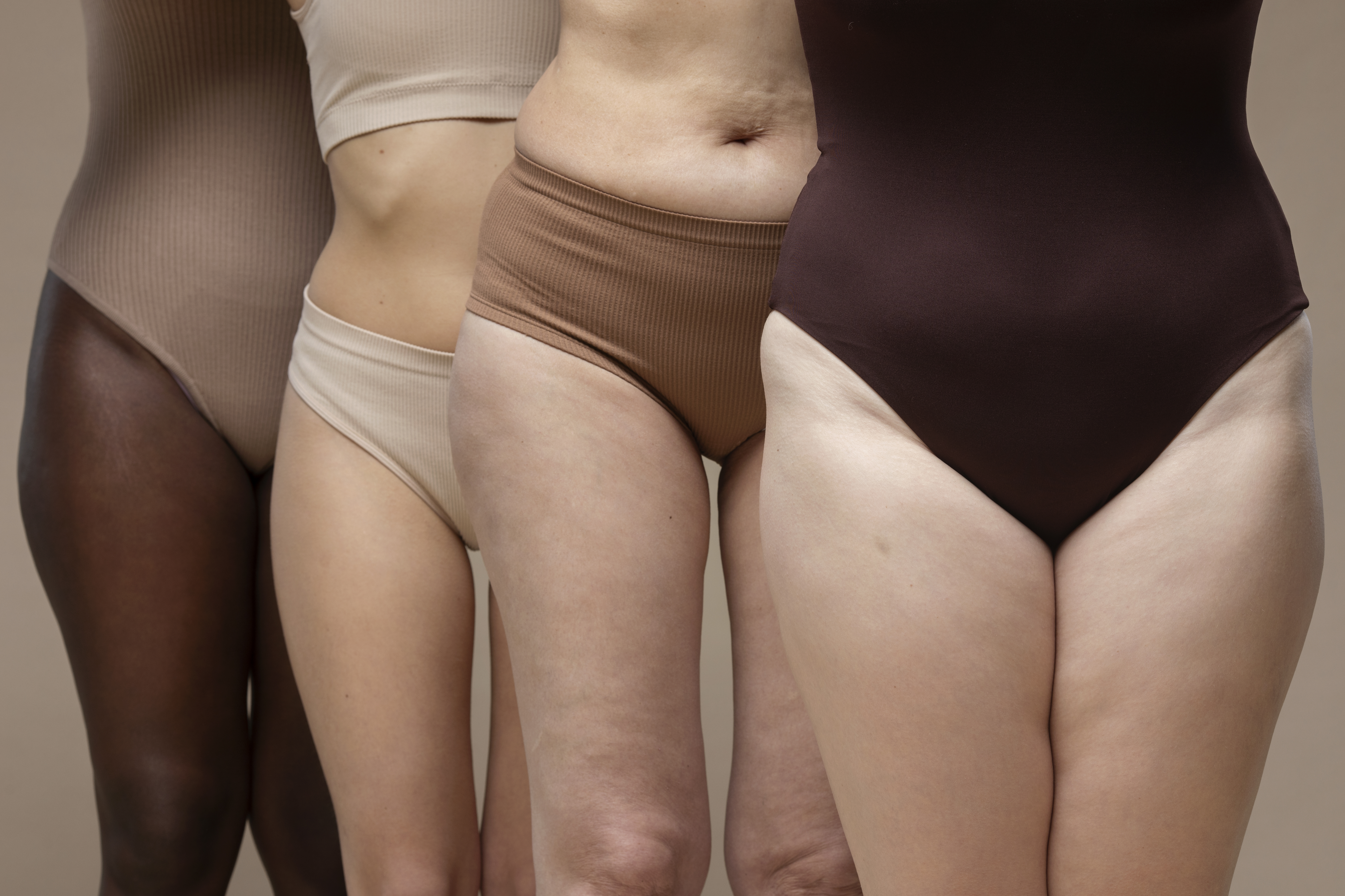 lipedema e celulite